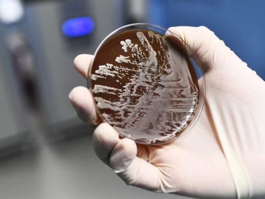 Científicos desarrollan tecnología para detectar bacterias en minutos