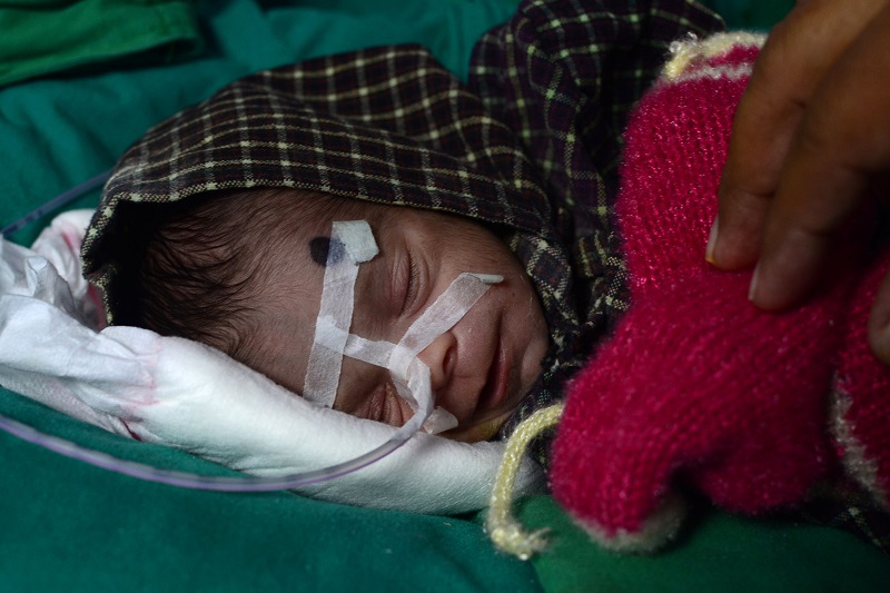 La neonata enterrada viva en India mejora según los médicos