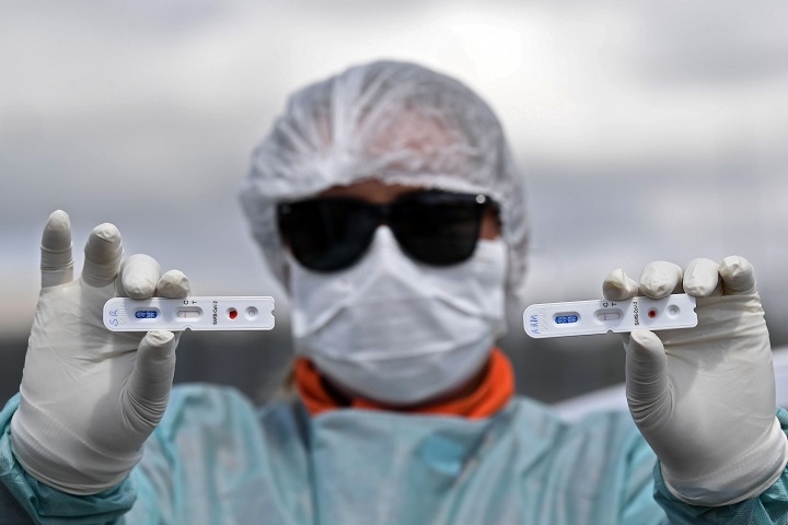 Brasil realiza primera prueba en masa para diagnosticar coronavirus