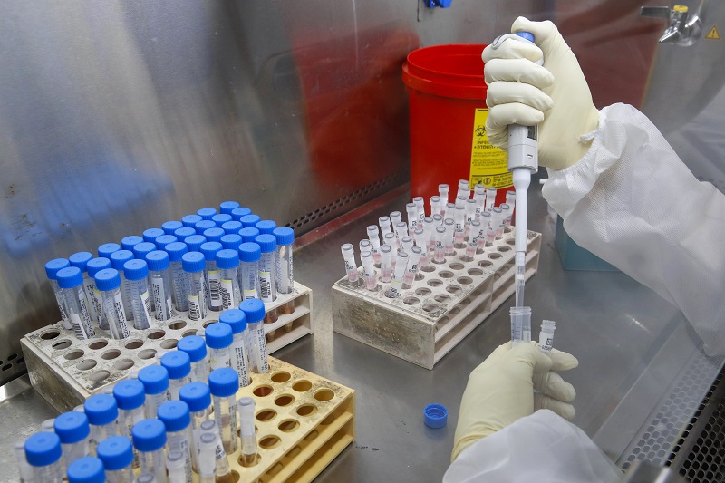 Una empresa israelí crea prueba que detecta el coronavirus en 30 segundos