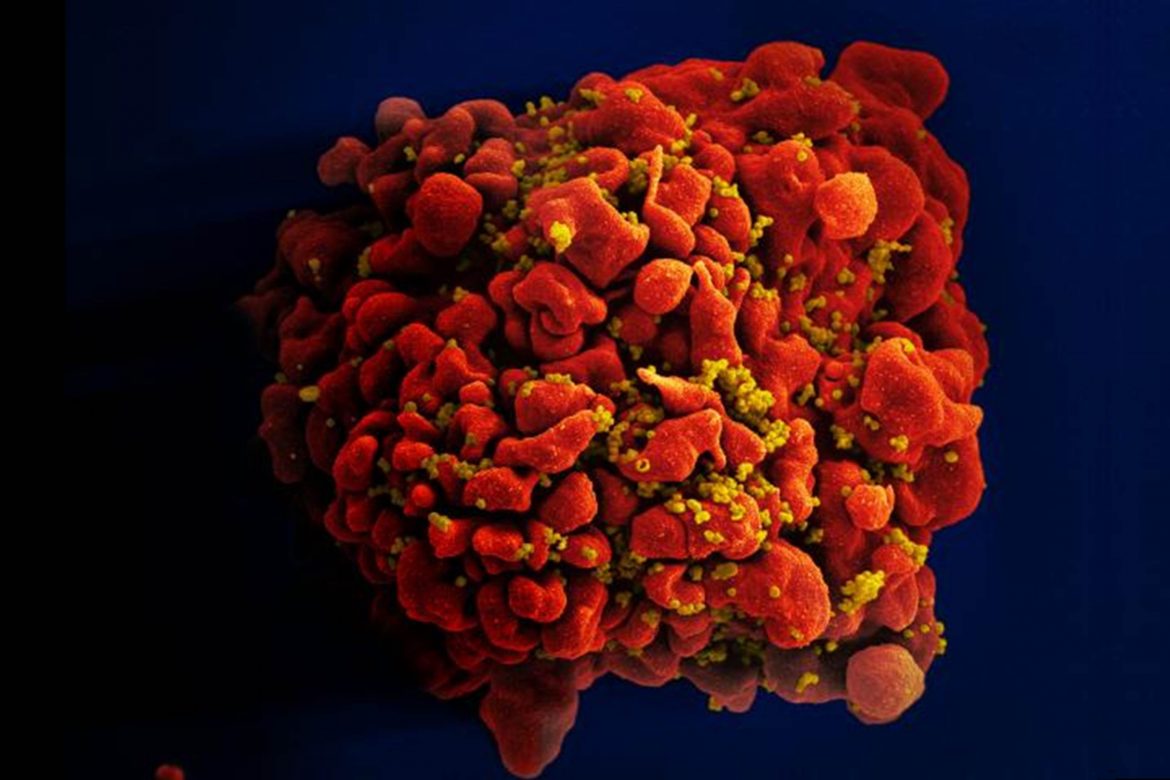EEUU añade agentes, incluido el VIH, a lista de cancerígenos