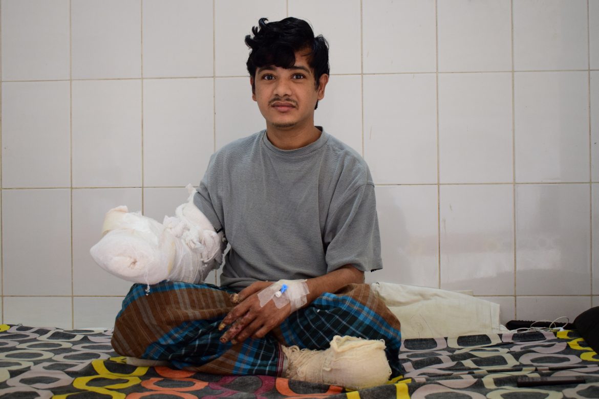 El "hombre árbol" saldrá pronto del hospital tras 16 operaciones en Bangladesh