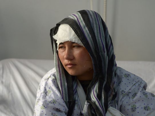 Zarina, una afgana mutilada por su marido suplica ayuda