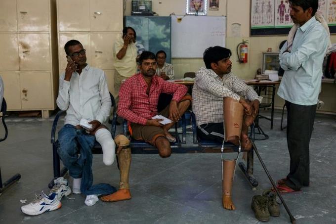 Las prótesis de bajo costo que vuelven a poner en pie a amputados en India