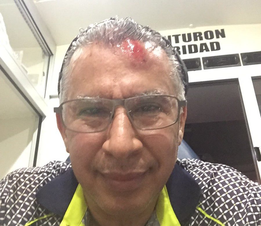 Director del CSS Alfredo Martiz sufre herida tras hecho de tránsito