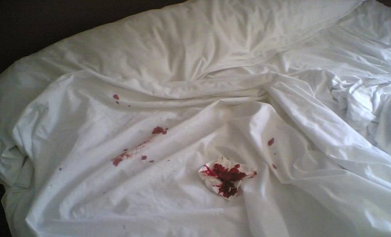 Adolescente parapléjica atacada por ratas en su cama en Francia