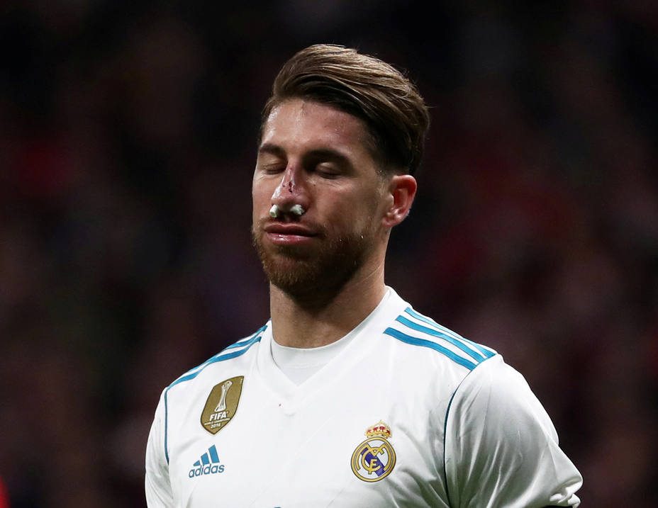 Real Madrid confirma fractura de nariz de Ramos