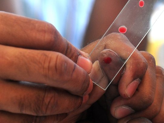 Nuevas pistas para facilitar la vida de los pacientes de VIH/sida