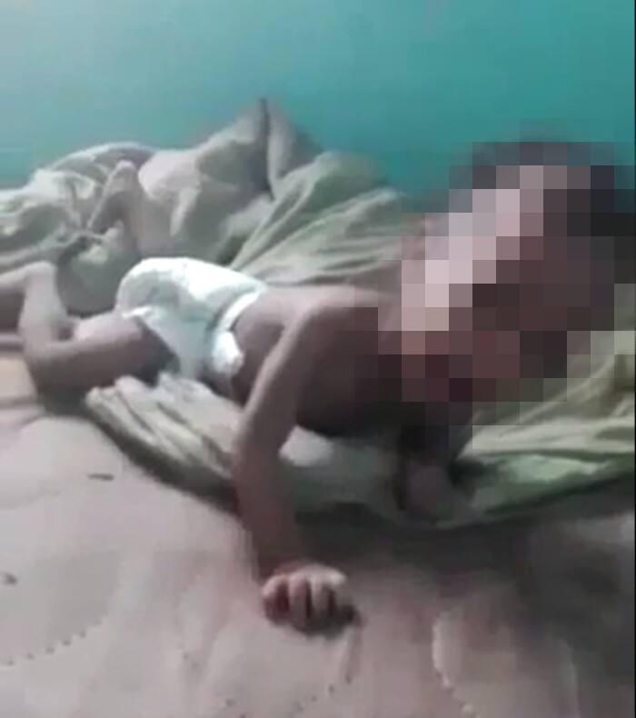 Rescatan a bebé en Colón tras denuncia de abandono y desnutrición