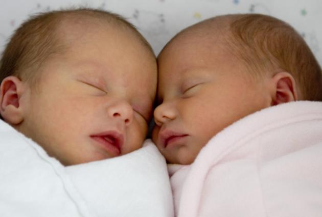 El asombroso caso de gemelos semiidénticos que sobrevivieron pese a ser incompatibles