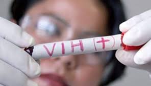 Probidsida reporta 64 casos de VIH positivo desde el 1 de enero hasta el 19 de febrero
