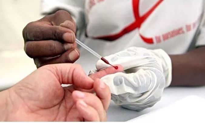 Tasa de infecciones por VIH en EE.UU cayó 73% entre 1981 y 2019, señala estudio
