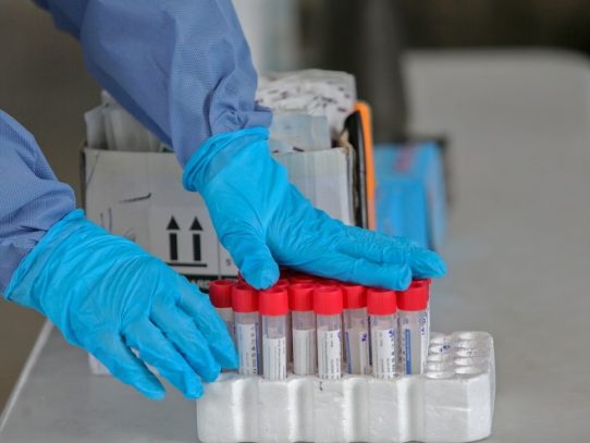 Inglaterra suprime los test de covid obligatorios para visitantes vacunados