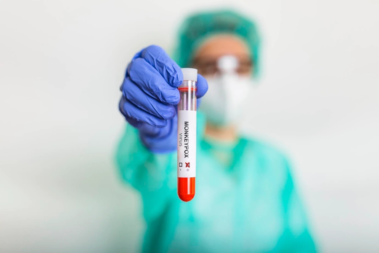 Confirmados dos nuevos casos de viruela símica en el país