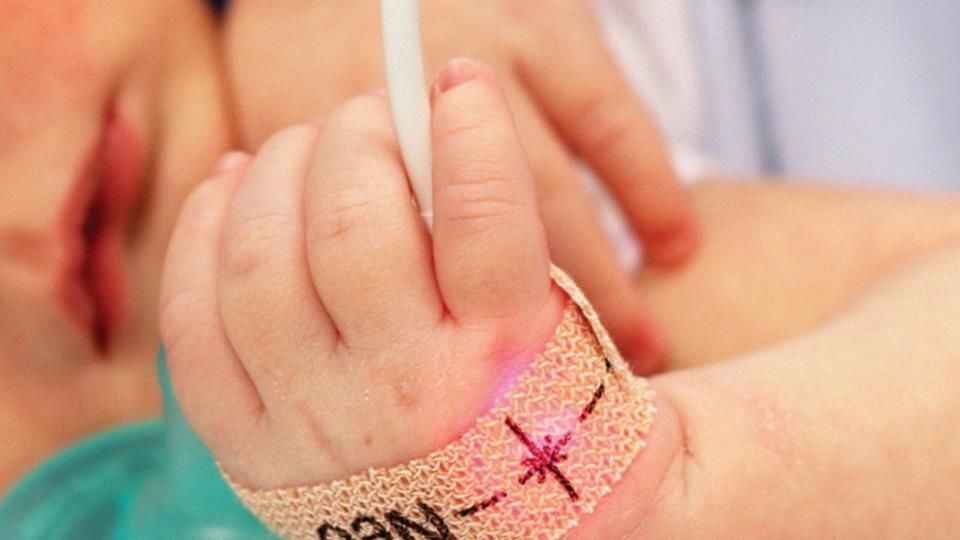 MINSA acotó que nueva ley de tamizaje mejorará la calidad de vida de los recién nacidos