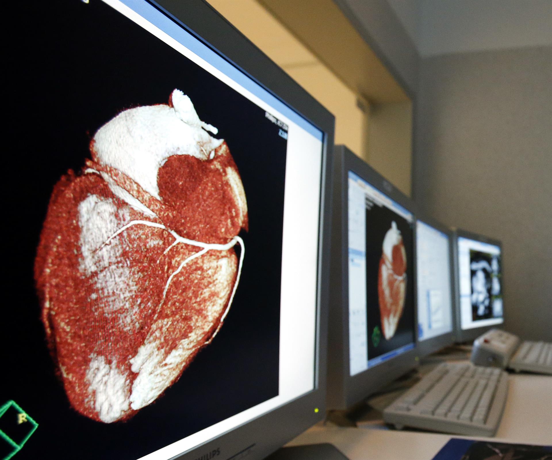 Salud promueve la reanimación cardíaca: "Si no haces nada, es un muerto"