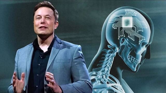 Elon Musk anuncia primer implante de chip cerebral en humano