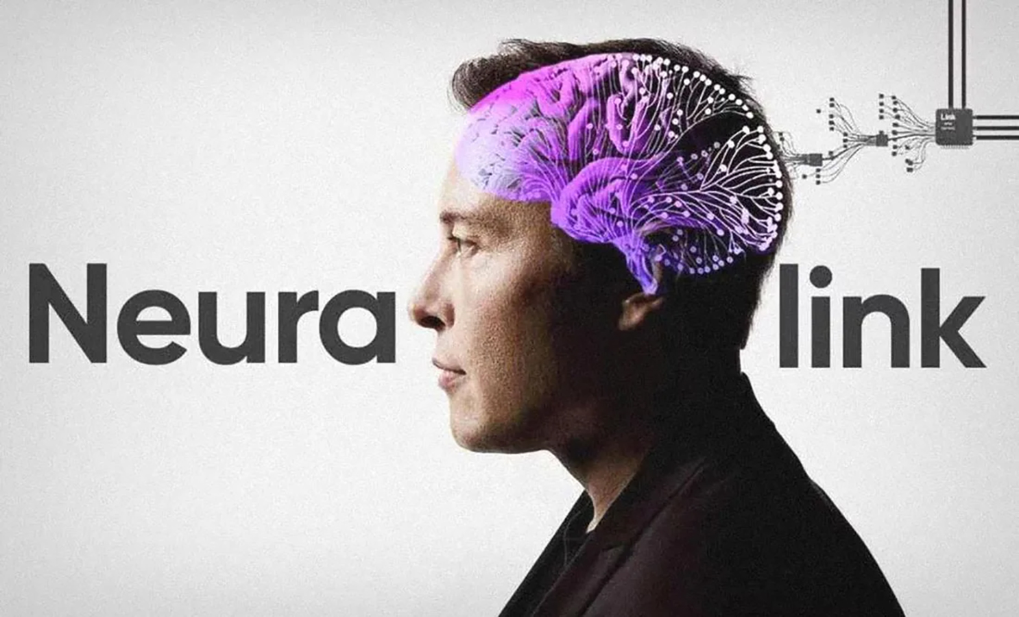 Telepathy, el chip cerebral de Elon Musk