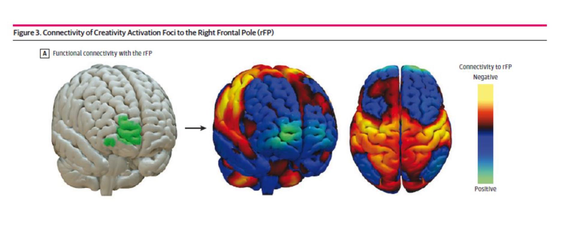 Identifican un circuito cerebral que implica a varias regiones y controla la creatividad