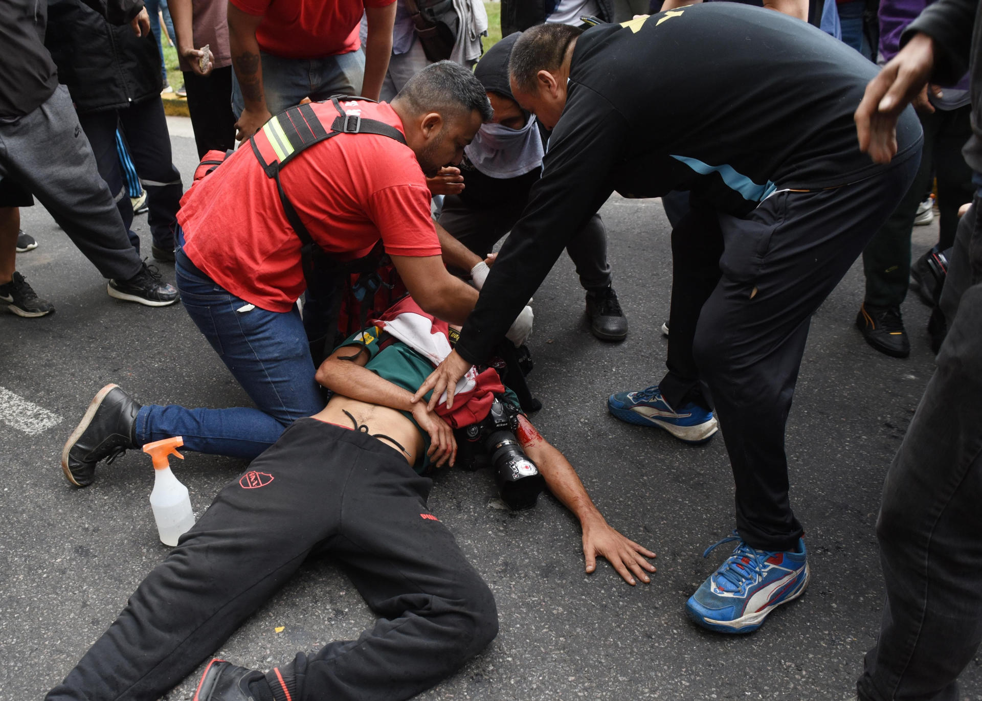 Fotógrafo argentino herido de bala por la Policía sigue en estado grave