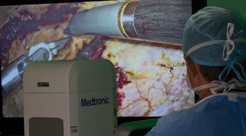 CSS realiza primera corrección de hernia abdominal con cirugía robótica