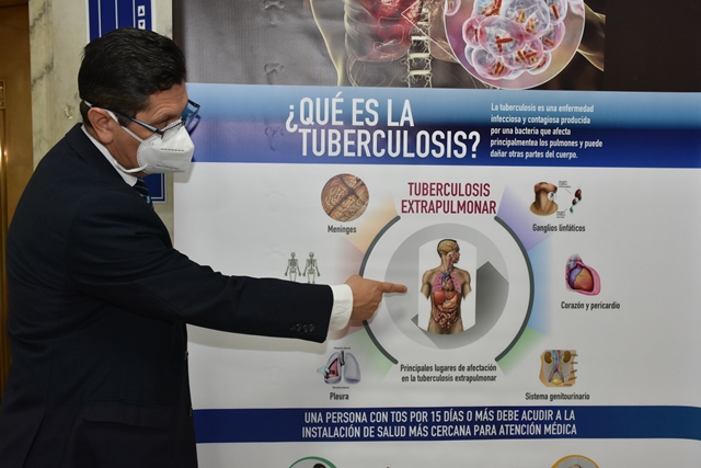 Panamá proyecta cierre el año con menos casos y muertes por tuberculosis