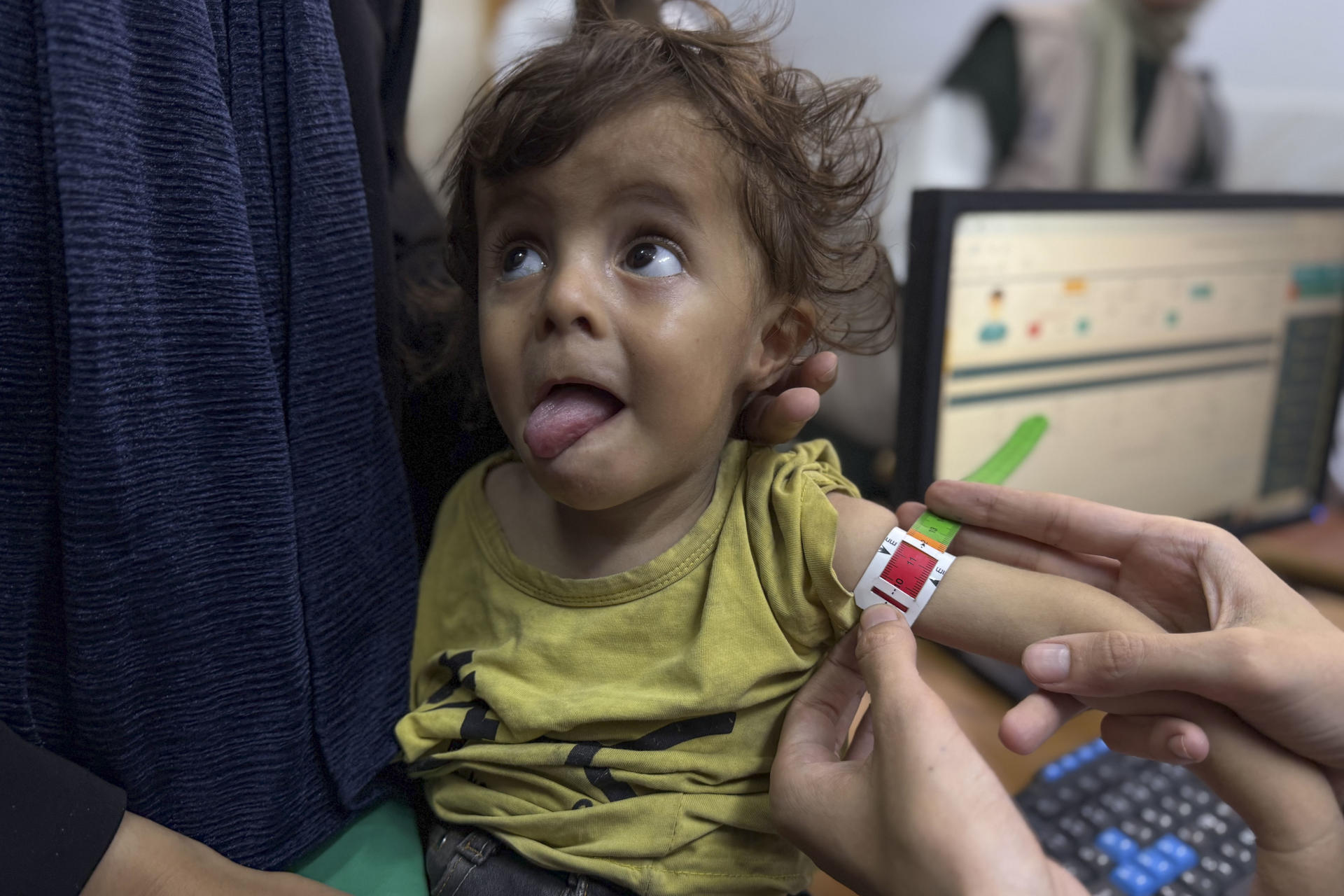 Otros 13 gazatíes mueren hambre en un solo día, incluidos tres niños