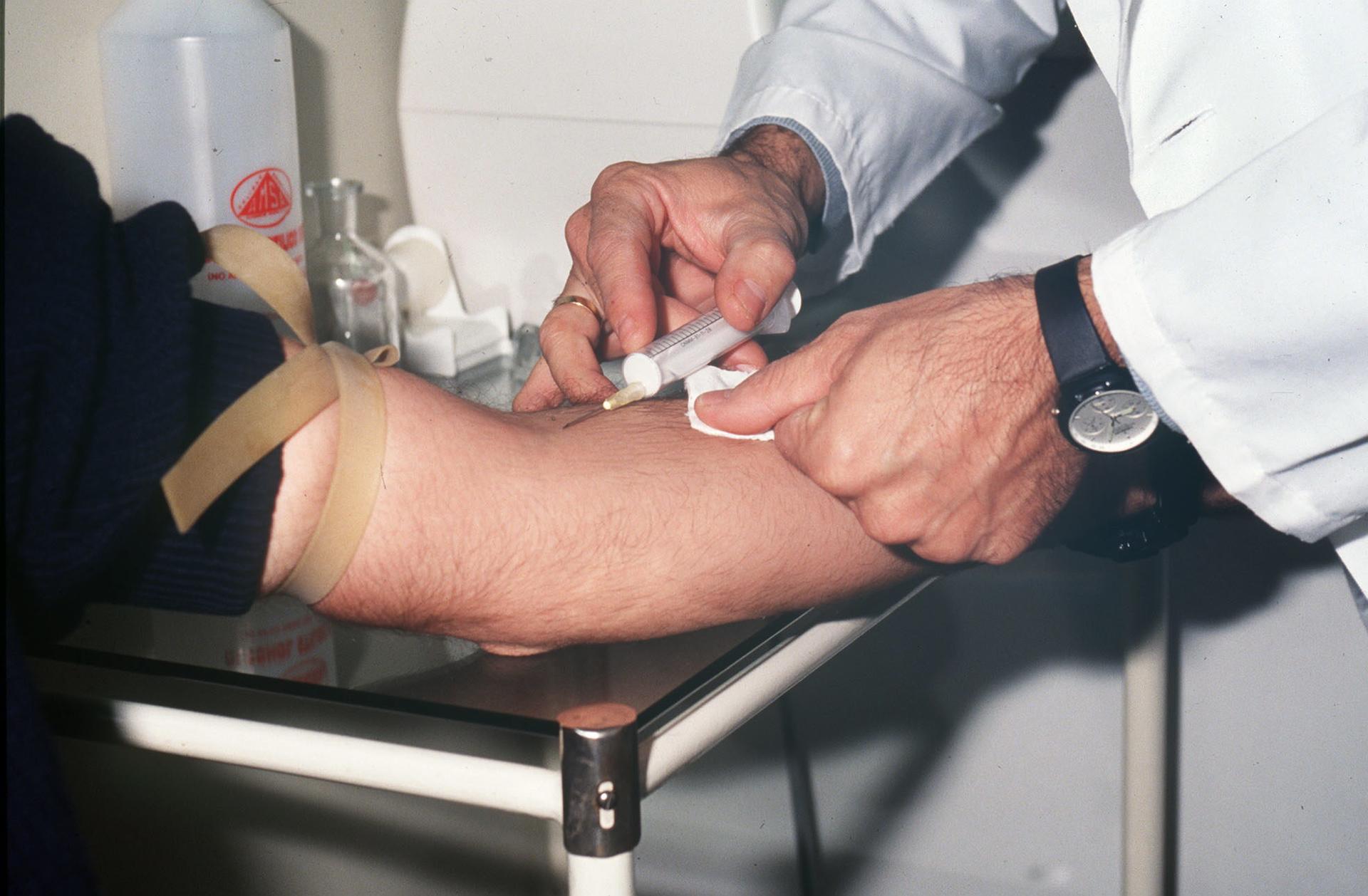 Un análisis genético podría detectar el párkinson antes de los primeros síntomas