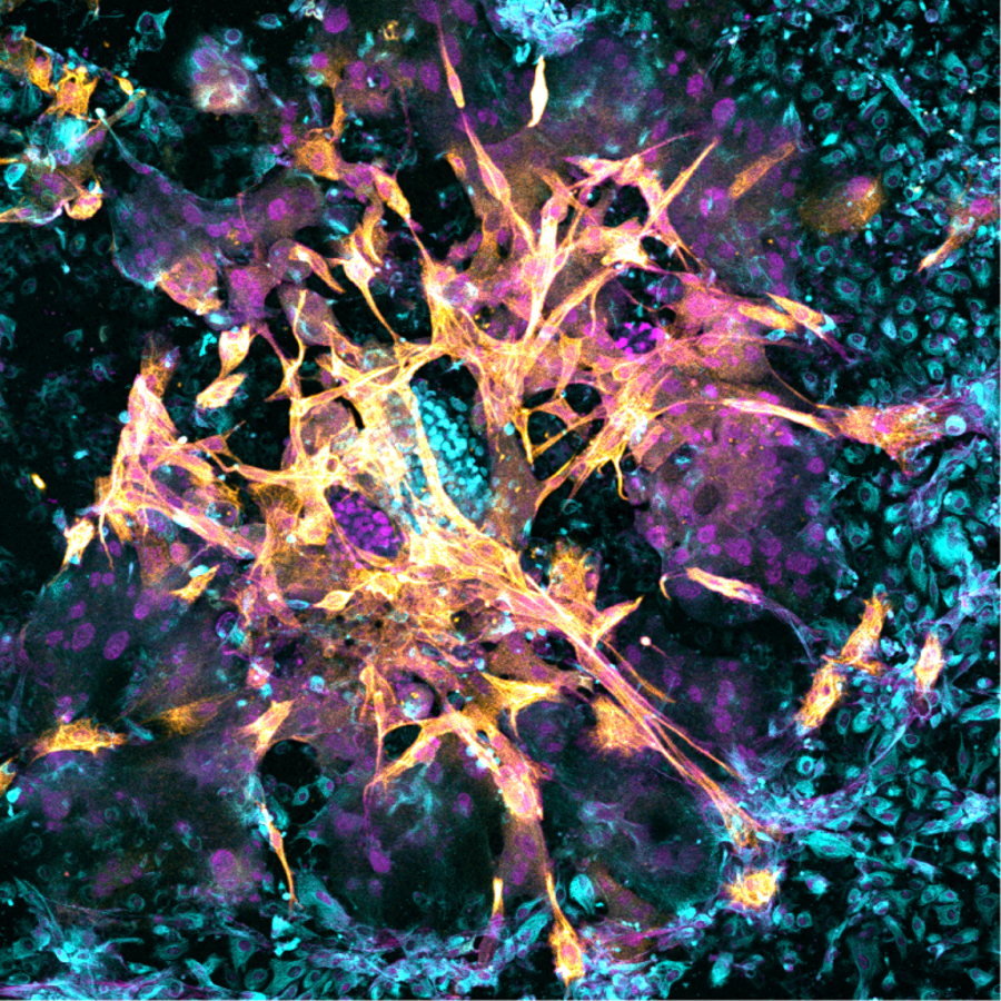 Científicos logran implantar con éxito un embrión en un endometrio artificial