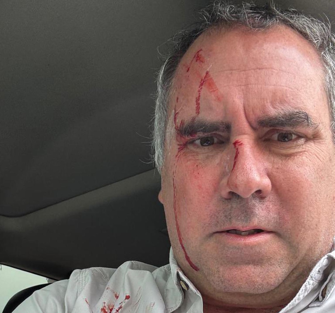 Candidato presidencial de Perú sobrevive tras ser tiroteado su vehículo