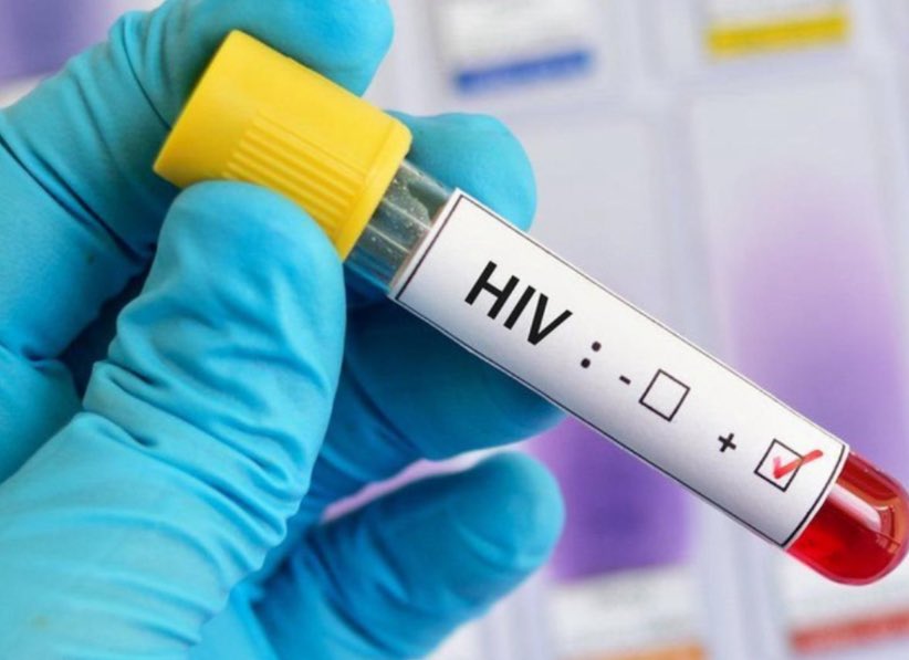 Aumentan casos de Sida entre jóvenes y alertan sobre riesgos durante el carnaval