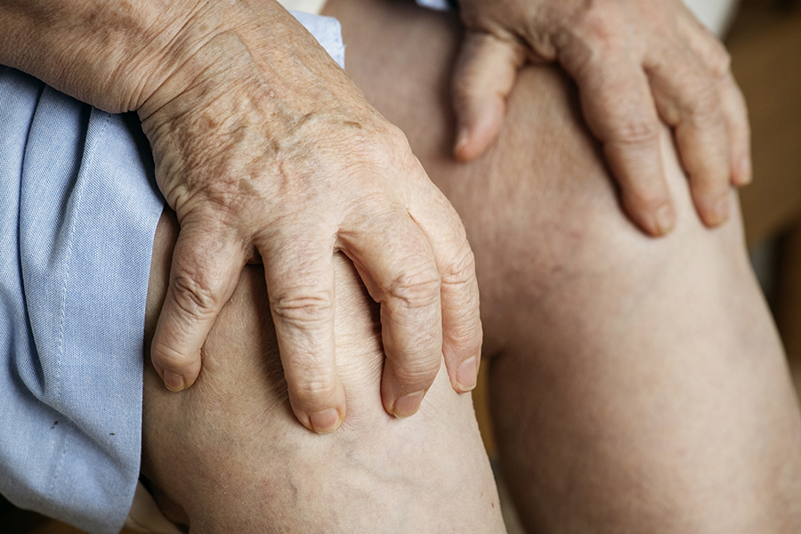 ConArtritis advierte del riesgo cardiovascular y la afectación neurológica asociados a las enfermedades reumáticas