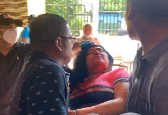 Una periodista herida en ataque con piedras de sandinistas contra opositores en Nicaragua