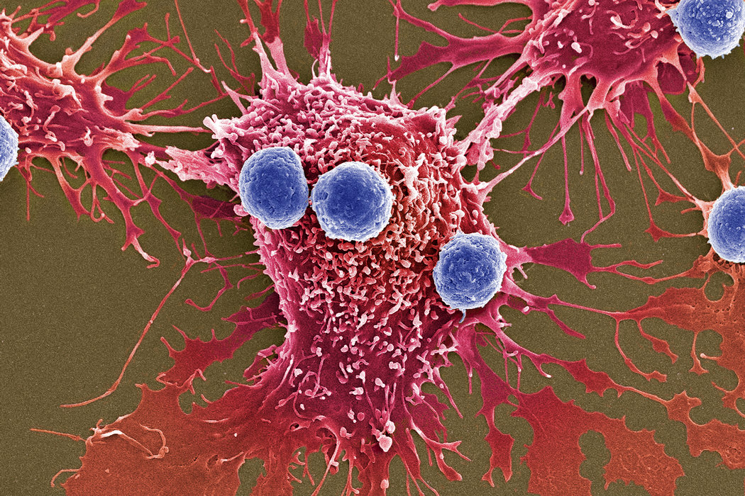Nuevas armas contra el cáncer: millones de bacterias programadas para matar
