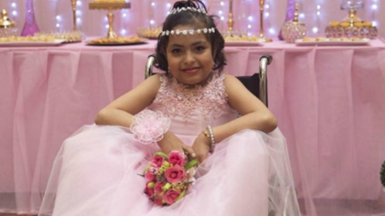 Muere a los 15 años la "niña sirena" de Perú