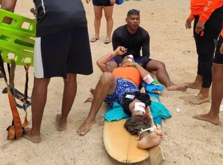 Bañista de Isla Mamey quiso hacerse selfie entre las rocas y terminó golpeado