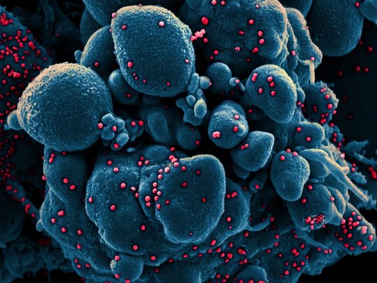 ¿Una mutación contribuyó a propagar el coronavirus? Hay más pruebas, pero persisten las preguntas